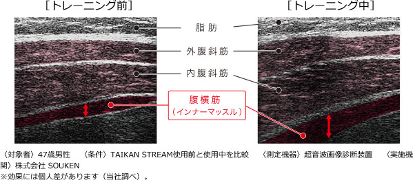 〈対象者〉47歳男性〈条件〉Taikan Stream使用前と使用中を比較〈測定機器〉超音波画像診断装置〈実施機関〉株式会社 Souken 効果には個人差があります（当社調べ）。